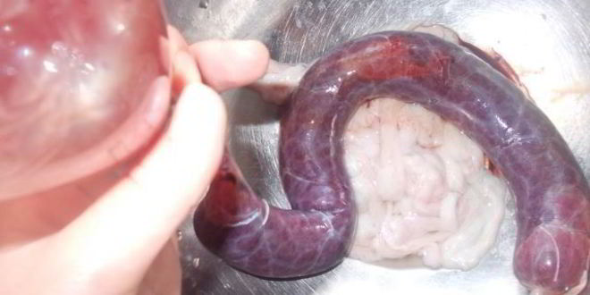 Рецепт гречнево-кровяная колбаса